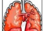 Enfermedades pulmonares de origen ocupacional | Recurso educativo 76237